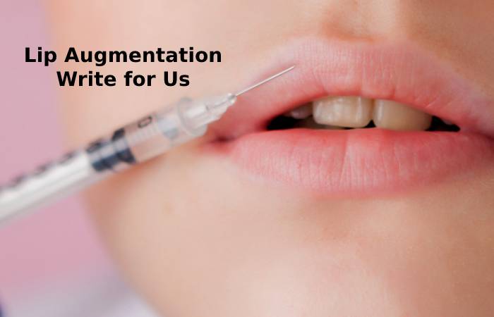 Lip Augmentation Write for Us