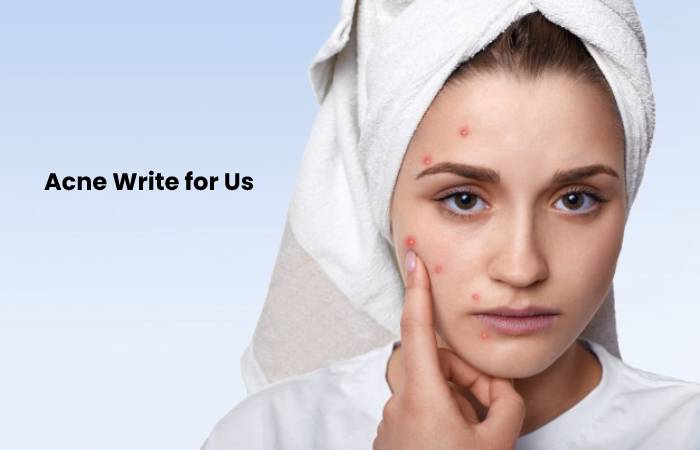 Acne write for us