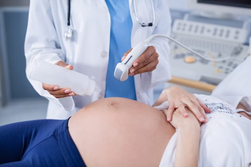 Prenatal Ultrasounds