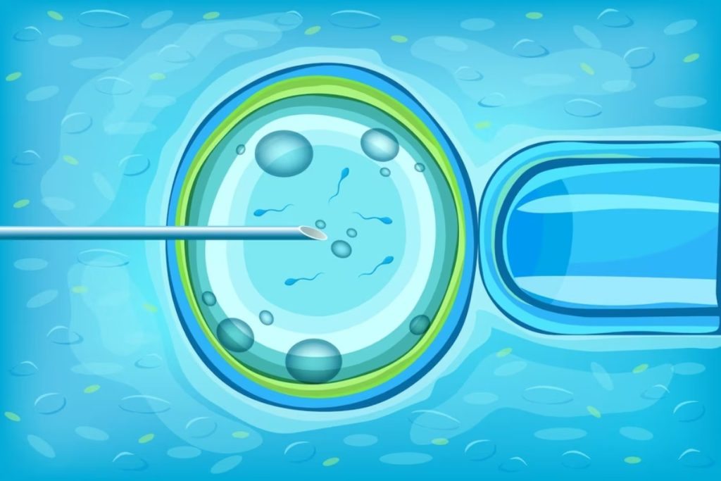Vitro Fertilization